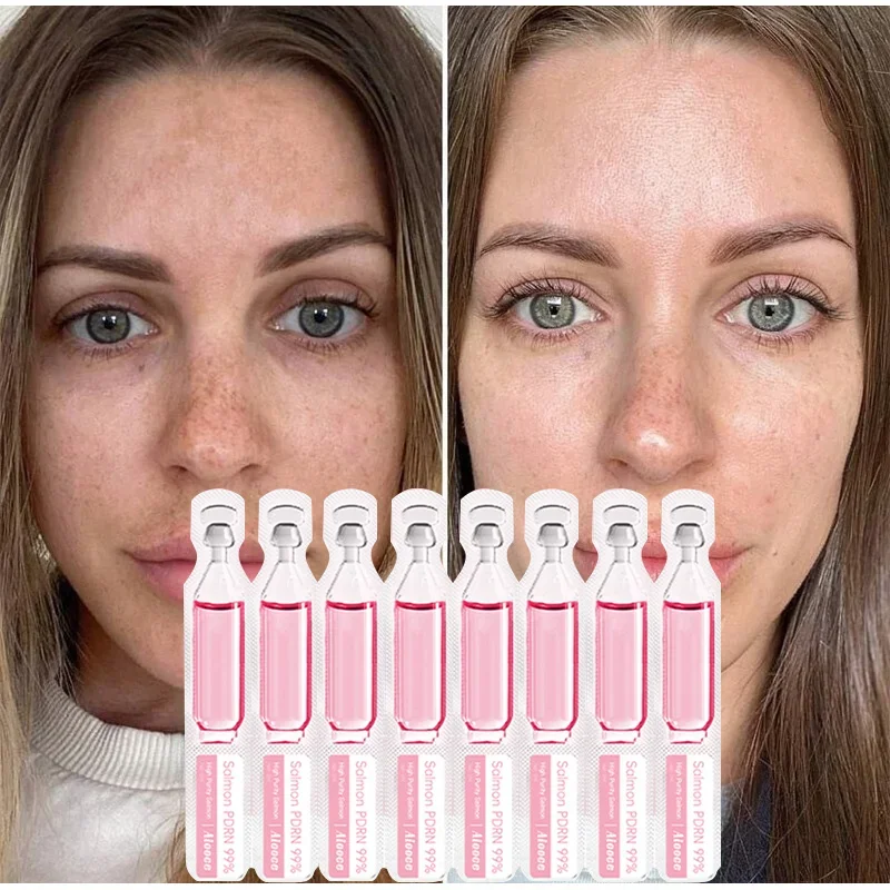 2ml*10 Vials Serum Pdrn Salmon - Luxury Skincare Brands 评论和价格